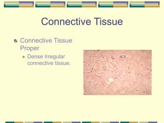 Connective Tissue
Connective Tissue
Proper
 Dense Irregular
connective tissue.
 