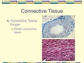 Connective Tissue
Connective Tissue
Proper
 Elastic connective
tissue
 