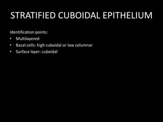STRATIFIED CUBOIDAL EPITHELIUM
Identification points:
• Multilayered
• Basal cells: high cuboidal or low columnar
• Surface layer: cuboidal

 