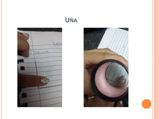 UÑA
 