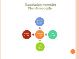 Gelatina
0.3 cm
Azúcar
0.4 cm
Uña
0.5 cm
Lunar
0.5 cm
Planta
0.5 cm
 