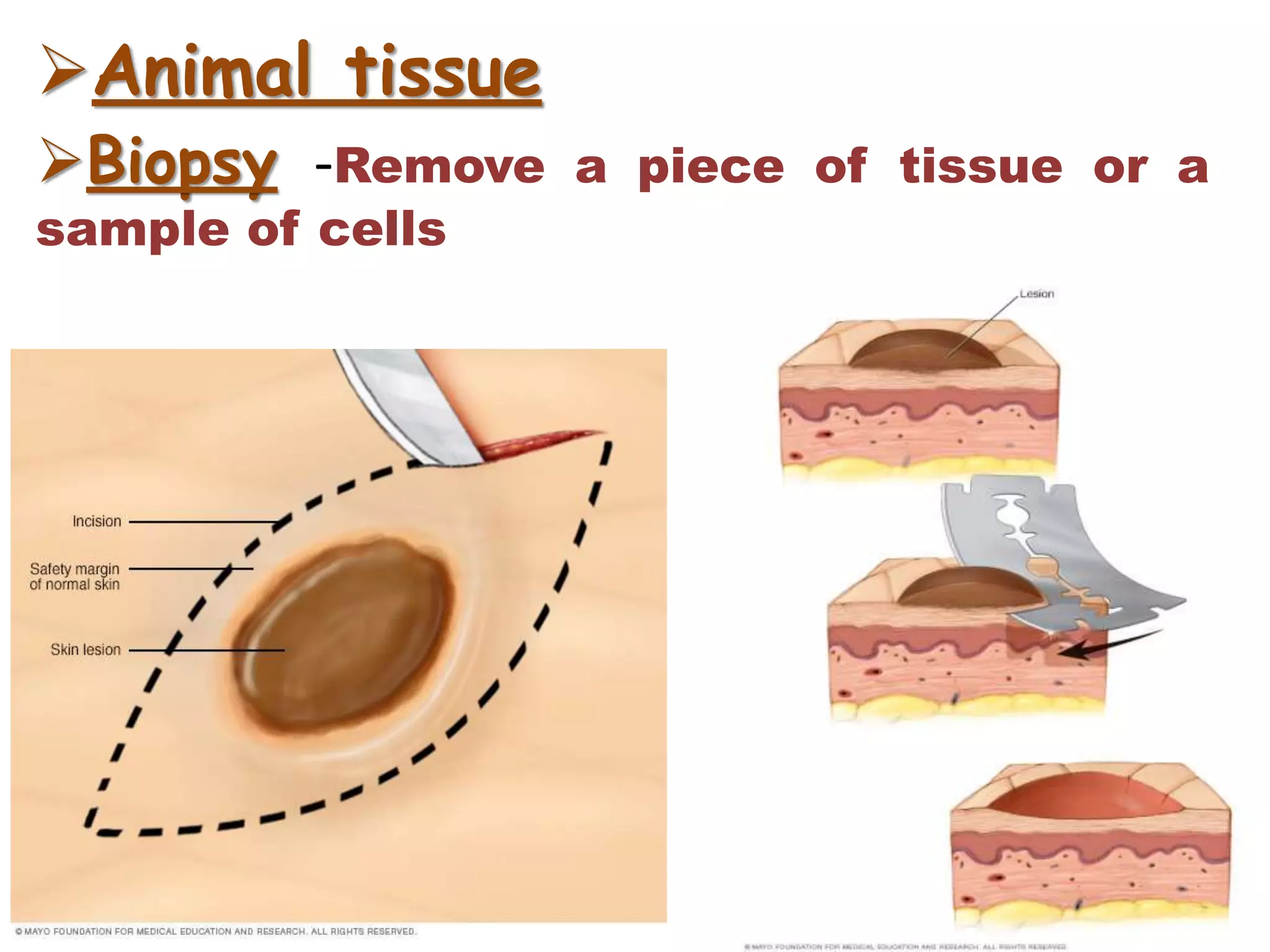Animal tissue
Biopsy -Remove a piece of tissue or a
sample of cells
 