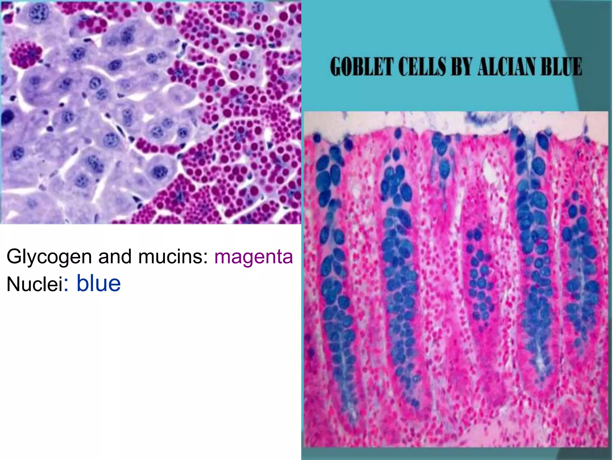 Glycogen and mucins: magenta
Nuclei: blue
 