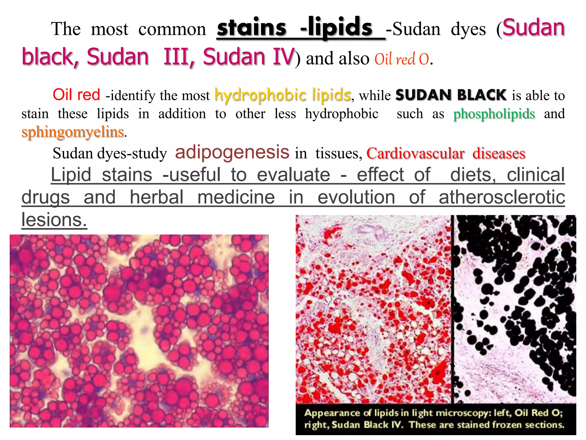 The most common stains -lipids -Sudan dyes (Sudan
black, Sudan III, Sudan IV) and also Oil red O.
Oil red -identify the most hydrophobic lipids, while SUDAN BLACK is able to
stain these lipids in addition to other less hydrophobic such as phospholipids and
sphingomyelins.
Sudan dyes-study adipogenesis in tissues, Cardiovascular diseases
Lipid stains -useful to evaluate - effect of diets, clinical
drugs and herbal medicine in evolution of atherosclerotic
lesions.
 