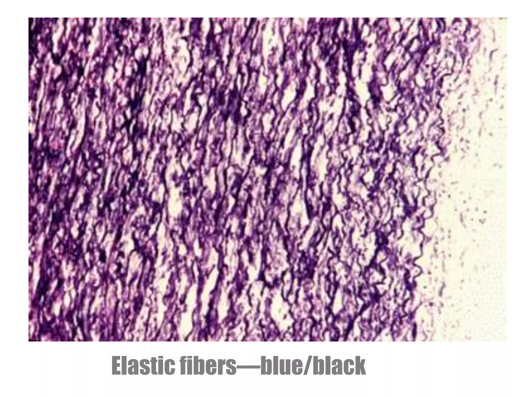 Elastic fibers—blue/black
 
