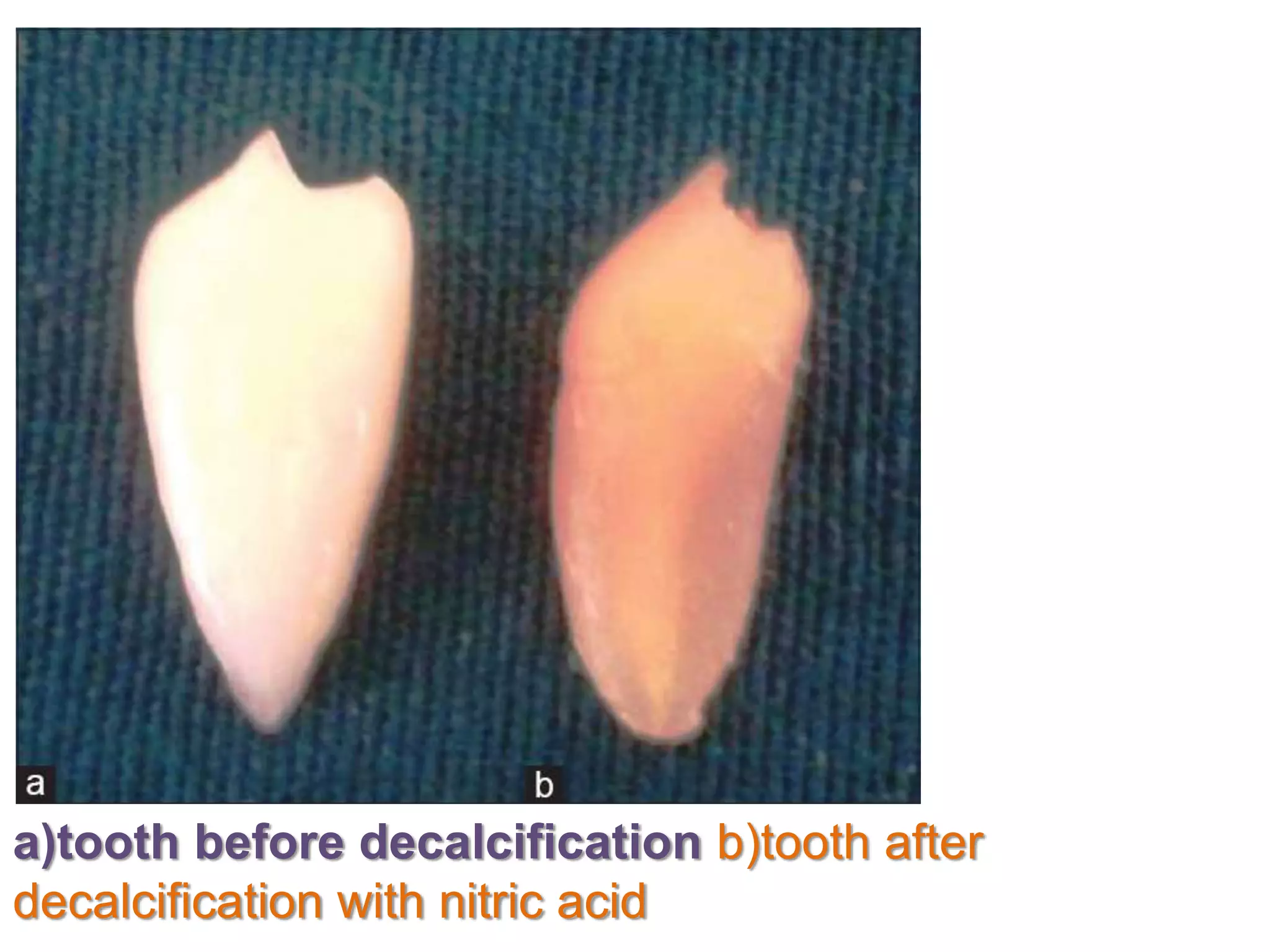a)tooth before decalcification b)tooth after
decalcification with nitric acid
 