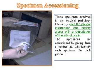 Tissue specimens received
in the surgical pathology
laboratory -lists the patient
information and history
along with a description
of the site of origin.
The specimens are
accessioned by giving them
a number that will identify
each specimen for each
patient.
 