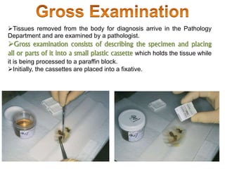 Tissues removed from the body for diagnosis arrive in the Pathology
Department and are examined by a pathologist.
Gross examination consists of describing the specimen and placing
all or parts of it into a small plastic cassette which holds the tissue while
it is being processed to a paraffin block.
Initially, the cassettes are placed into a fixative.
 