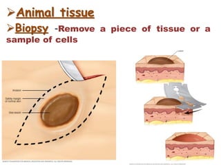 Animal tissue
Biopsy -Remove a piece of tissue or a
sample of cells
 