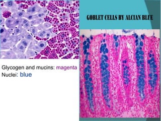 Glycogen and mucins: magenta
Nuclei: blue
 