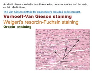 An elastic tissue stain helps to outline arteries, because arteries, and the aorta,
contain elastic fibers.
The Van Gieson method for elastic fibers provides good contrast.
Verhoeff-Van Gieson staining
Weigert’s resorcin-Fuchsin staining
Orcein staining
 