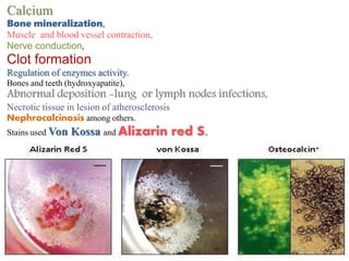 Calcium
Bone mineralization,
Muscle and blood vessel contraction,
Nerve conduction,
Clot formation
Regulation of enzymes activity.
Bones and teeth (hydroxyapatite),
Abnormal deposition -lung or lymph nodes infections,
Necrotic tissue in lesion of atherosclerosis
Nephrocalcinosis among others.
Stains used Von Kossa and Alizarin red S.
 