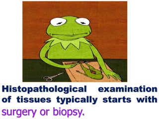 Histopathological examination
of tissues typically starts with
surgery or biopsy.
 