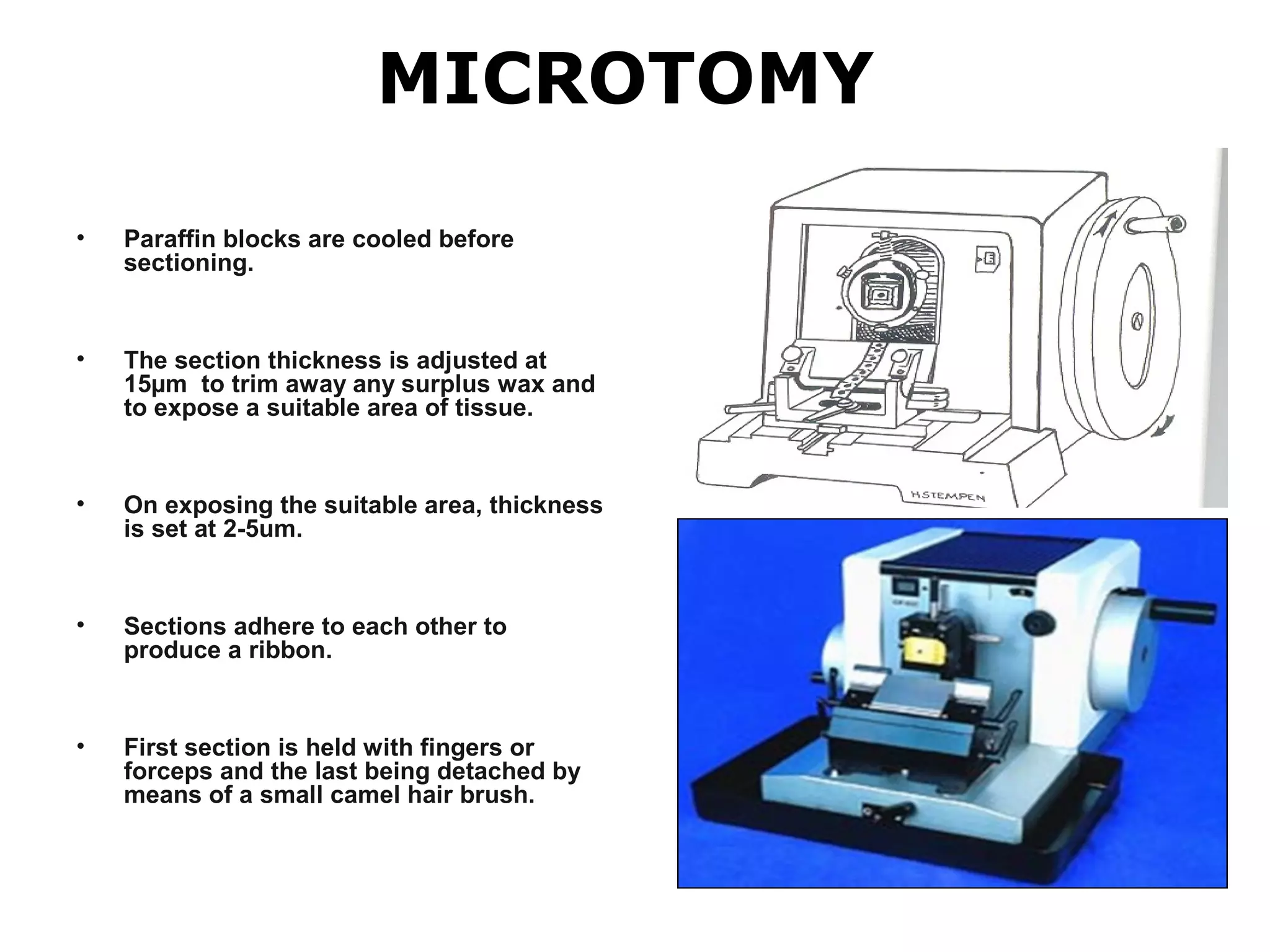 MICROTOMY
• Paraffin blocks are cooled before
sectioning.
• The section thickness is adjusted at
15µm to trim away any surplus wax and
to expose a suitable area of tissue.
• On exposing the suitable area, thickness
is set at 2-5um.
• Sections adhere to each other to
produce a ribbon.
• First section is held with fingers or
forceps and the last being detached by
means of a small camel hair brush.
 