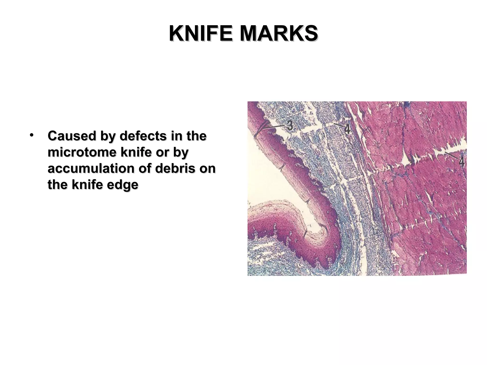 KNIFE MARKSKNIFE MARKS
• Caused by defects in theCaused by defects in the
microtome knife or bymicrotome knife or by
accumulation of debris onaccumulation of debris on
the knife edgethe knife edge
 
