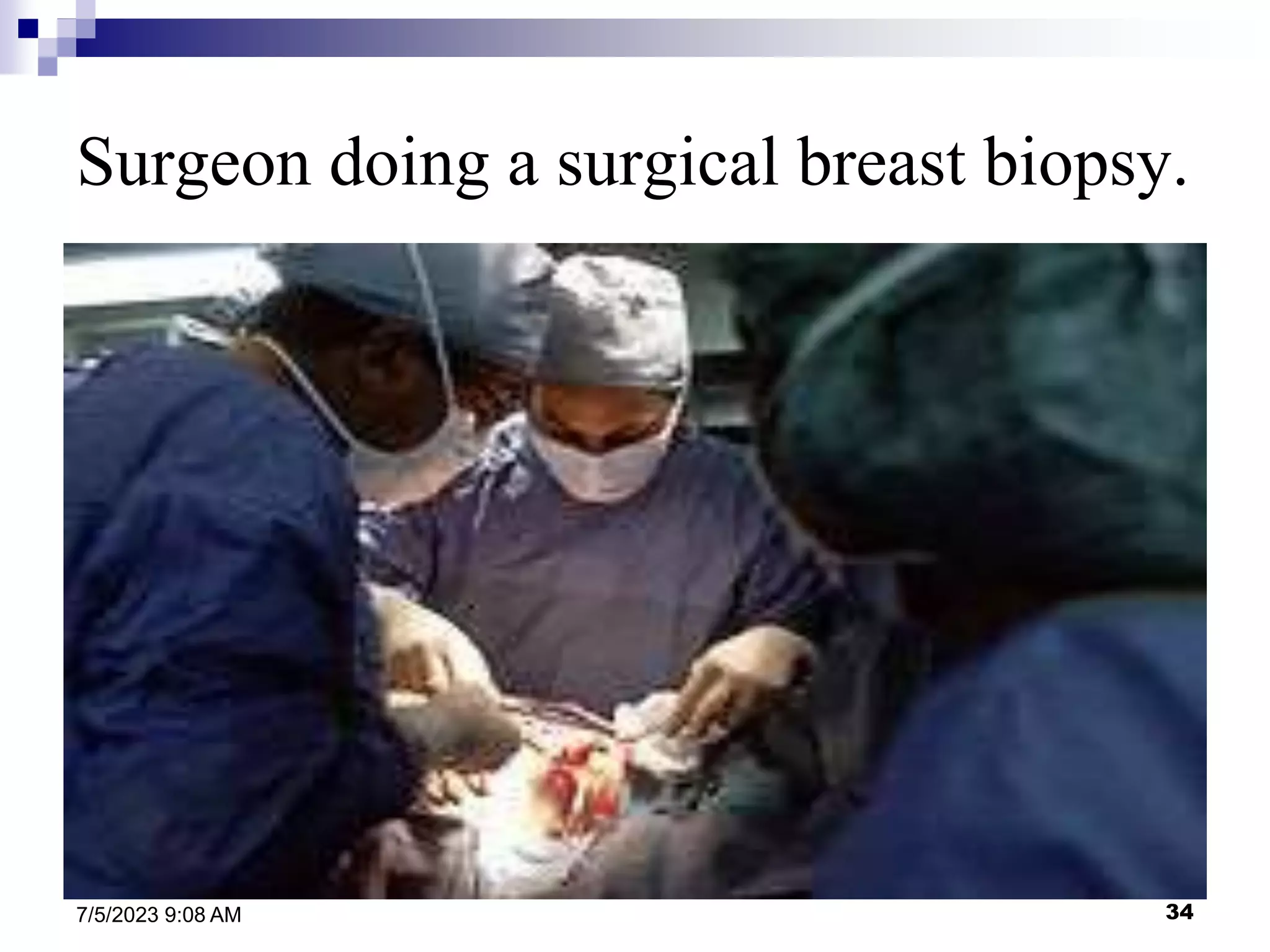 34
7/5/2023 9:08 AM
Surgeon doing a surgical breast biopsy.
.
 