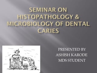 PRESENTED BY
ASHISH KARODE
MDS STUDENT
 