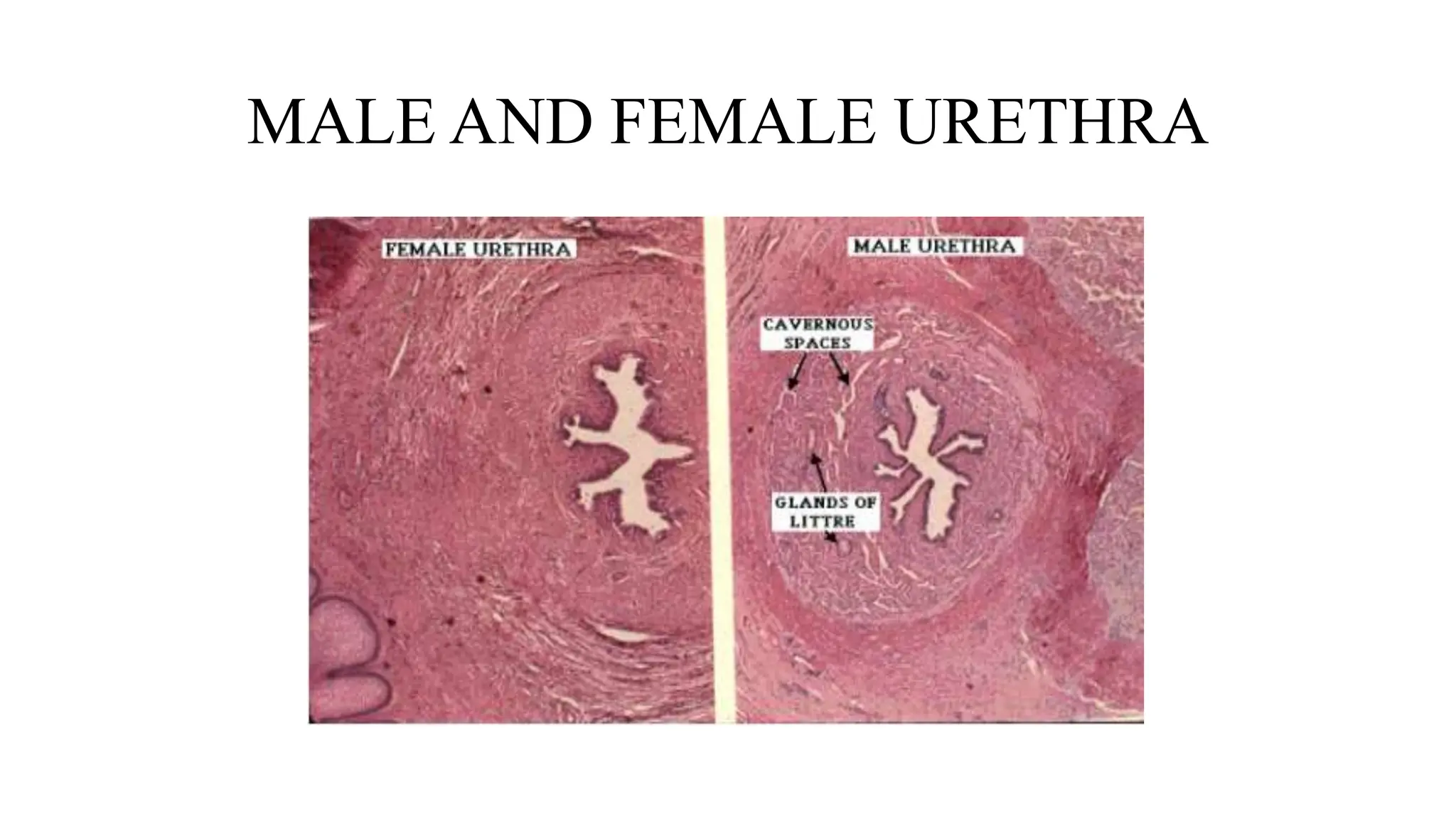 histopathology of bladder and urethra.pptx