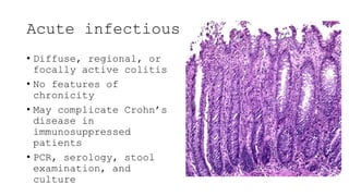 Histopathology of Crohn's disease - Rawa Muhsin | PPTX