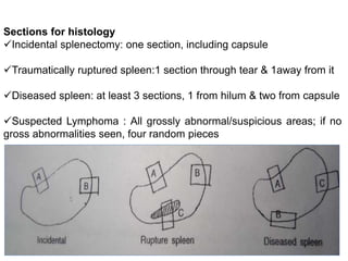 Sections for histology
Incidental splenectomy: one section, including capsule
Traumatically ruptured spleen:1 section through tear & 1away from it
Diseased spleen: at least 3 sections, 1 from hilum & two from capsule
Suspected Lymphoma : All grossly abnormal/suspicious areas; if no
gross abnormalities seen, four random pieces
 