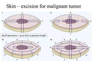 Skin – excision for malignant tumor
Small specimens – up to 5cm in greatest length
 