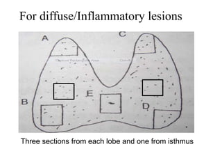 For diffuse/Inflammatory lesions
Three sections from each lobe and one from isthmus
 
