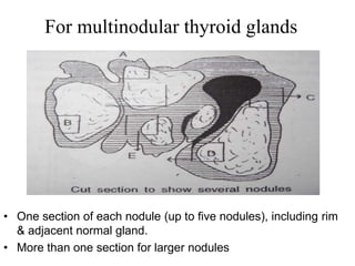For multinodular thyroid glands
• One section of each nodule (up to five nodules), including rim
& adjacent normal gland.
• More than one section for larger nodules
 