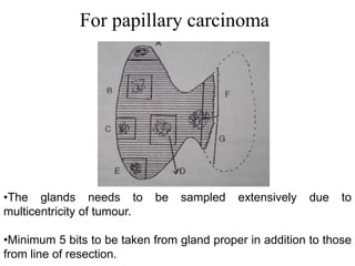 For papillary carcinoma
•The glands needs to be sampled extensively due to
multicentricity of tumour.
•Minimum 5 bits to be taken from gland proper in addition to those
from line of resection.
 