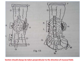 Section should always be taken perpendicular to the direction of mucosal folds
 