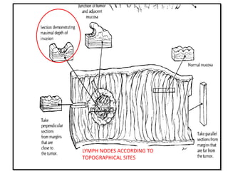 LYMPH NODES ACCORDING TO
TOPOGRAPHICAL SITES
 