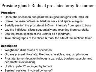 Prostate gland: Radical prostatectomy for tumor
Procedure
• Orient the specimen and paint the surgical margins with India ink
• Shave the vasa deferentia, bladder neck and apical margins
• Serially section the prostate at 2–3 mm intervals from apex to base
• Lay the individual slices sequentially and examine them carefully.
• Use the cross-section of the urethra as a landmark
• Take photographs of the slices & mark the site of the sections taken
Description
• Weight and dimensions of specimen
• Organs present: Prostate, Urethra, s. vesicles, vas, lymph nodes
• Prostate: tumor (location in lobes, size, color, borders, capsular and
periprostatic extension)
• Urethra: patent? impinged by tumor?
• Seminal vesicles: involved by tumor?
 