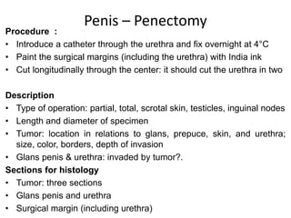 Penis – Penectomy
Procedure :
• Introduce a catheter through the urethra and fix overnight at 4°C
• Paint the surgical margins (including the urethra) with India ink
• Cut longitudinally through the center: it should cut the urethra in two
Description
• Type of operation: partial, total, scrotal skin, testicles, inguinal nodes
• Length and diameter of specimen
• Tumor: location in relations to glans, prepuce, skin, and urethra;
size, color, borders, depth of invasion
• Glans penis & urethra: invaded by tumor?.
Sections for histology
• Tumor: three sections
• Glans penis and urethra
• Surgical margin (including urethra)
 