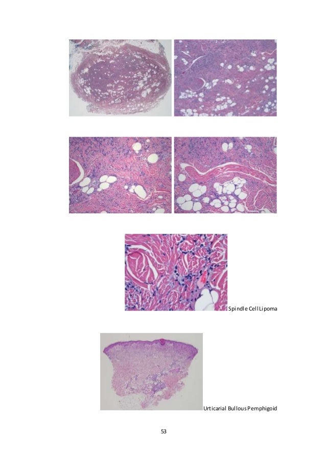 Histopathplogical photos
