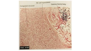 Caseation Hitopath histopath slides.pptx mbbs Second year . | PPTX