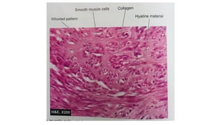 Caseation Hitopath histopath slides.pptx mbbs Second year . | PPTX