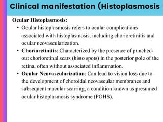 Clinical manifestation (Histoplasmosis
Ocular Histoplasmosis:
• Ocular histoplasmosis refers to ocular complications
associated with histoplasmosis, including chorioretinitis and
ocular neovascularization.
• Chorioretinitis: Characterized by the presence of punched-
out chorioretinal scars (histo spots) in the posterior pole of the
retina, often without associated inflammation.
• Ocular Neovascularization: Can lead to vision loss due to
the development of choroidal neovascular membranes and
subsequent macular scarring, a condition known as presumed
ocular histoplasmosis syndrome (POHS).
 