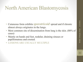 NorthAmerican Blastomycosis
• Cutaneous form exhibits sporotricoid spread and if chronic
almost always originates in the lungs.
• Most common site of dissemination from lung is the skin. (80% of
cases)
• Mainly on hands and feet, nodular, draining sinuses or
papillomatous and crusted.
• LESIONS ARE USUALLY MULTIPLE
11
2/3/2021
Shabir
Imteyaz
Khan
 