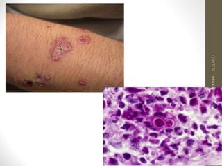 12
2/3/2021
Shabir
Imteyaz
Khan
 