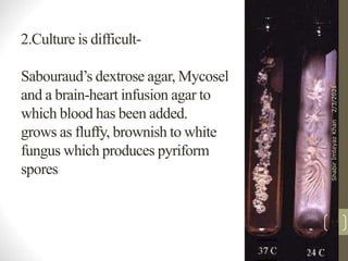 2.Culture is difficult-
Sabouraud’s dextrose agar, Mycosel
and a brain-heart infusion agar to
which blood has been added.
grows as fluffy, brownish to white
fungus which produces pyriform
spores
15
2/3/2021
Shabir
Imteyaz
Khan
 
