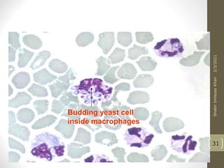 Budding yeast cell
inside macrophages
31
2/3/2021
Shabir
Imteyaz
Khan
 
