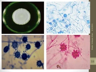 Tuberculate
macroconidia
33
2/3/2021
Shabir
Imteyaz
Khan
 