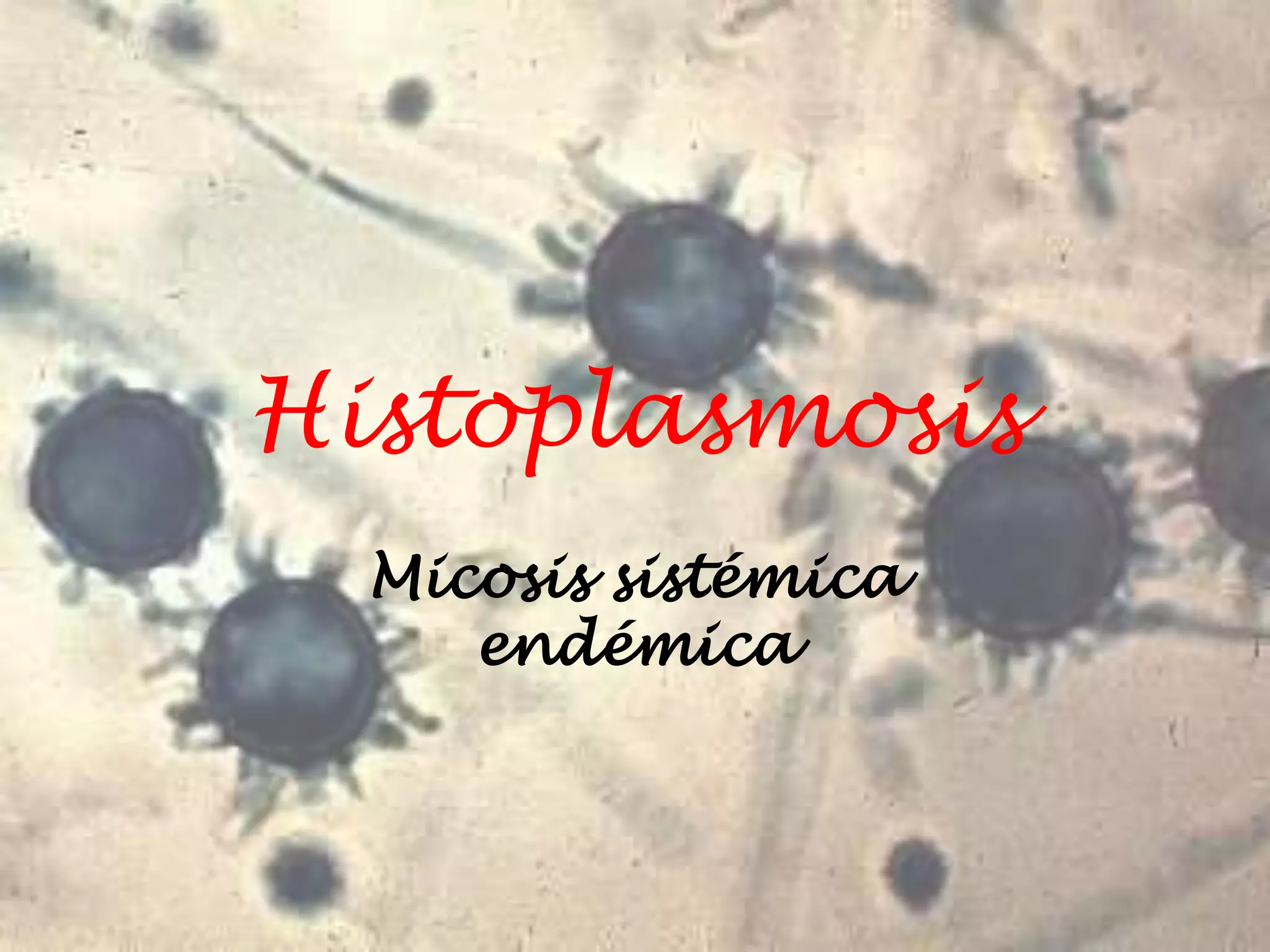 Histoplasmosis
Micosis sistémica
endémica

 