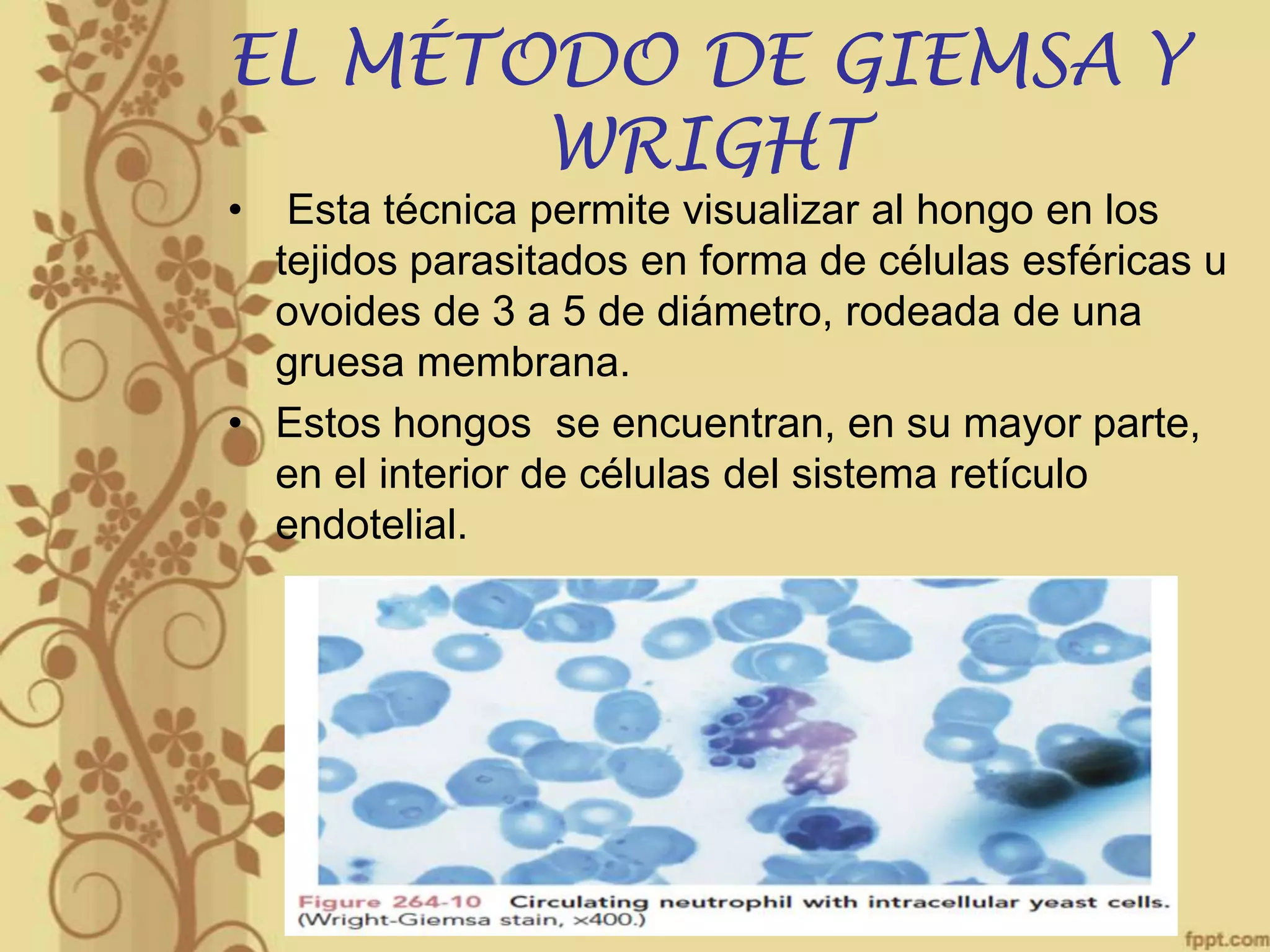 EL MÉTODO DE GIEMSA Y
WRIGHT
•

Esta técnica permite visualizar al hongo en los
tejidos parasitados en forma de células esféricas u
ovoides de 3 a 5 de diámetro, rodeada de una
gruesa membrana.
• Estos hongos se encuentran, en su mayor parte,
en el interior de células del sistema retículo
endotelial.

 