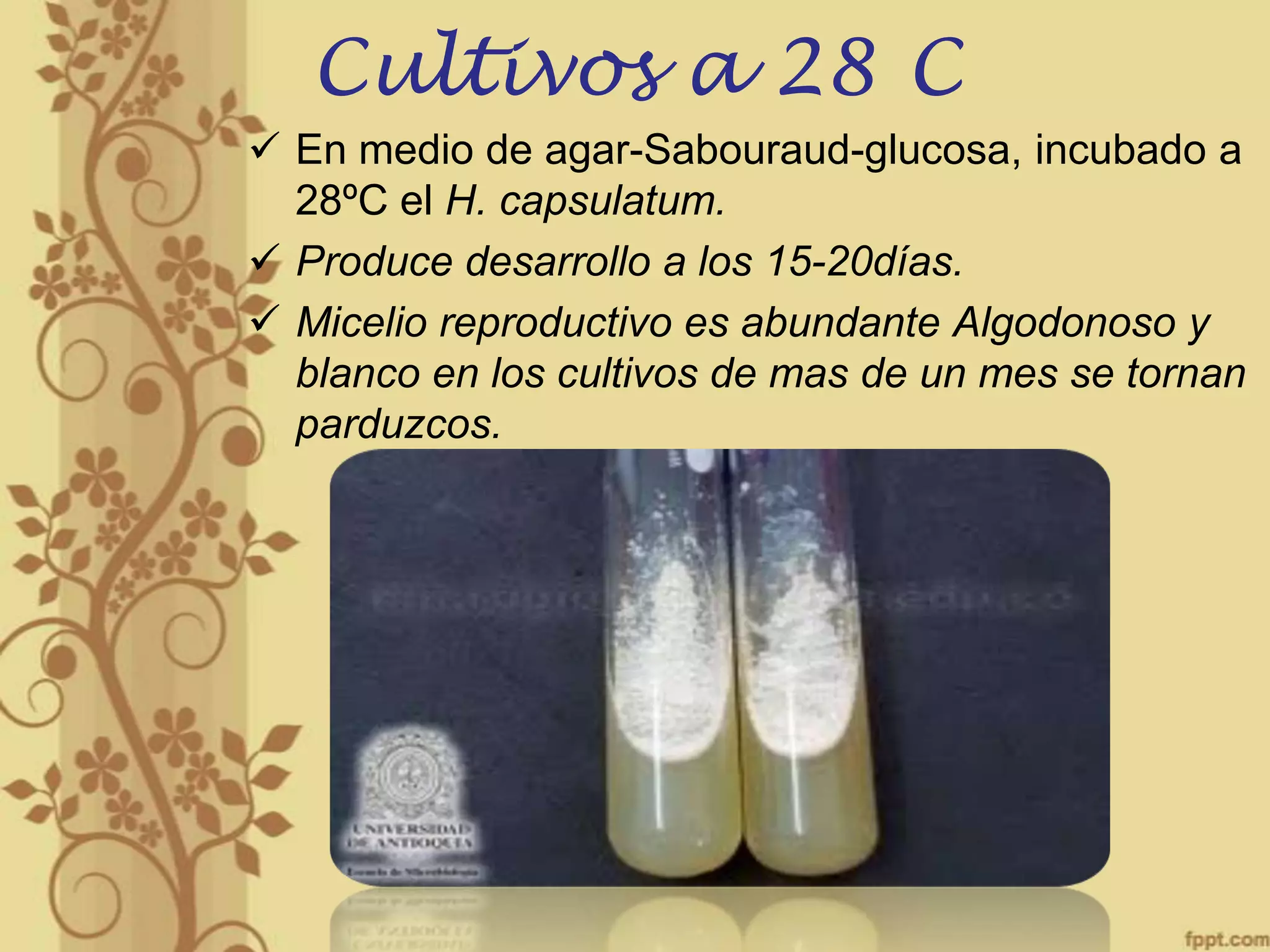 Cultivos a 28 C
 En medio de agar-Sabouraud-glucosa, incubado a
28ºC el H. capsulatum.
 Produce desarrollo a los 15-20días.
 Micelio reproductivo es abundante Algodonoso y
blanco en los cultivos de mas de un mes se tornan
parduzcos.

 