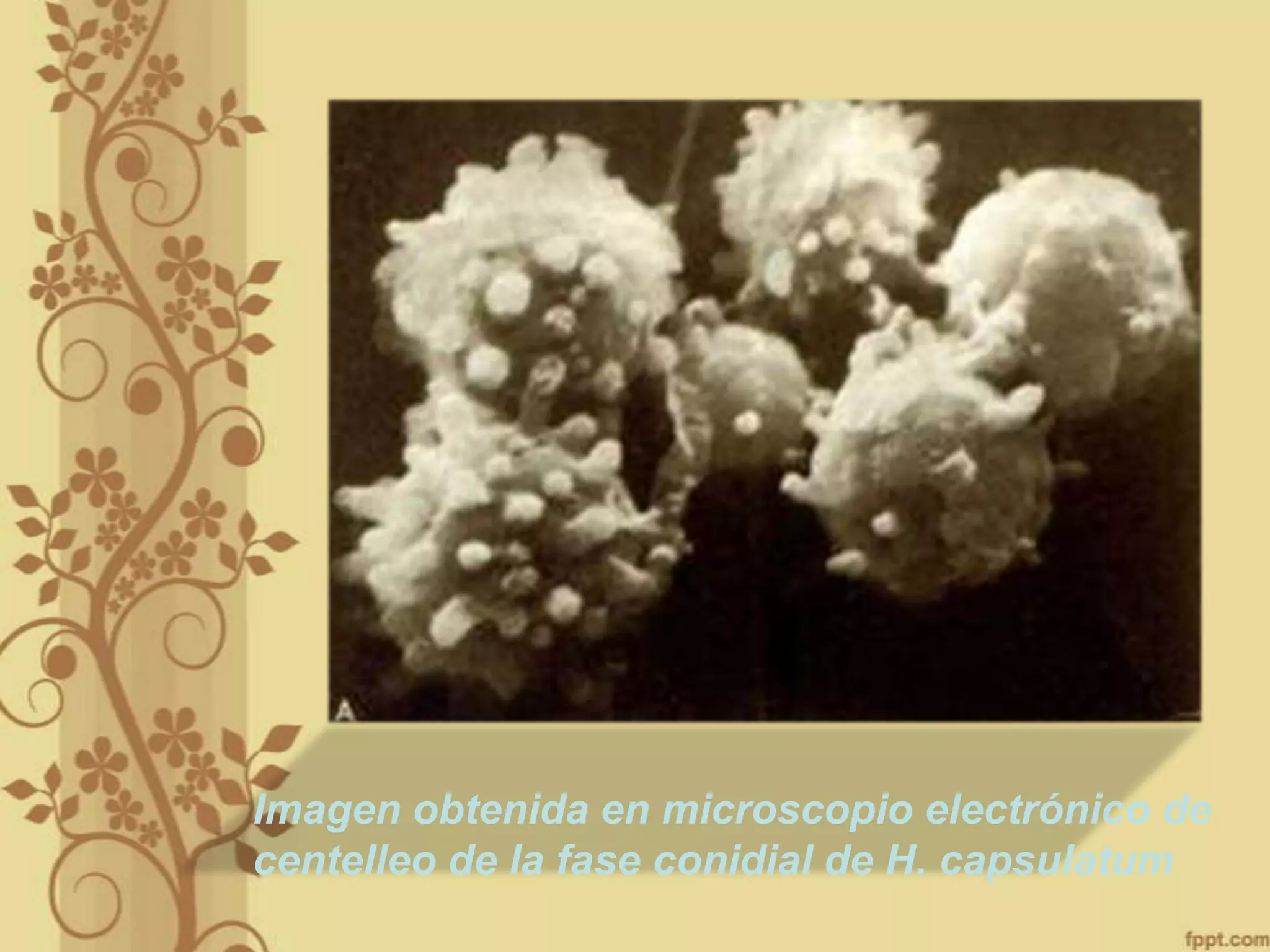 Imagen obtenida en microscopio electrónico de
centelleo de la fase conidial de H. capsulatum

 