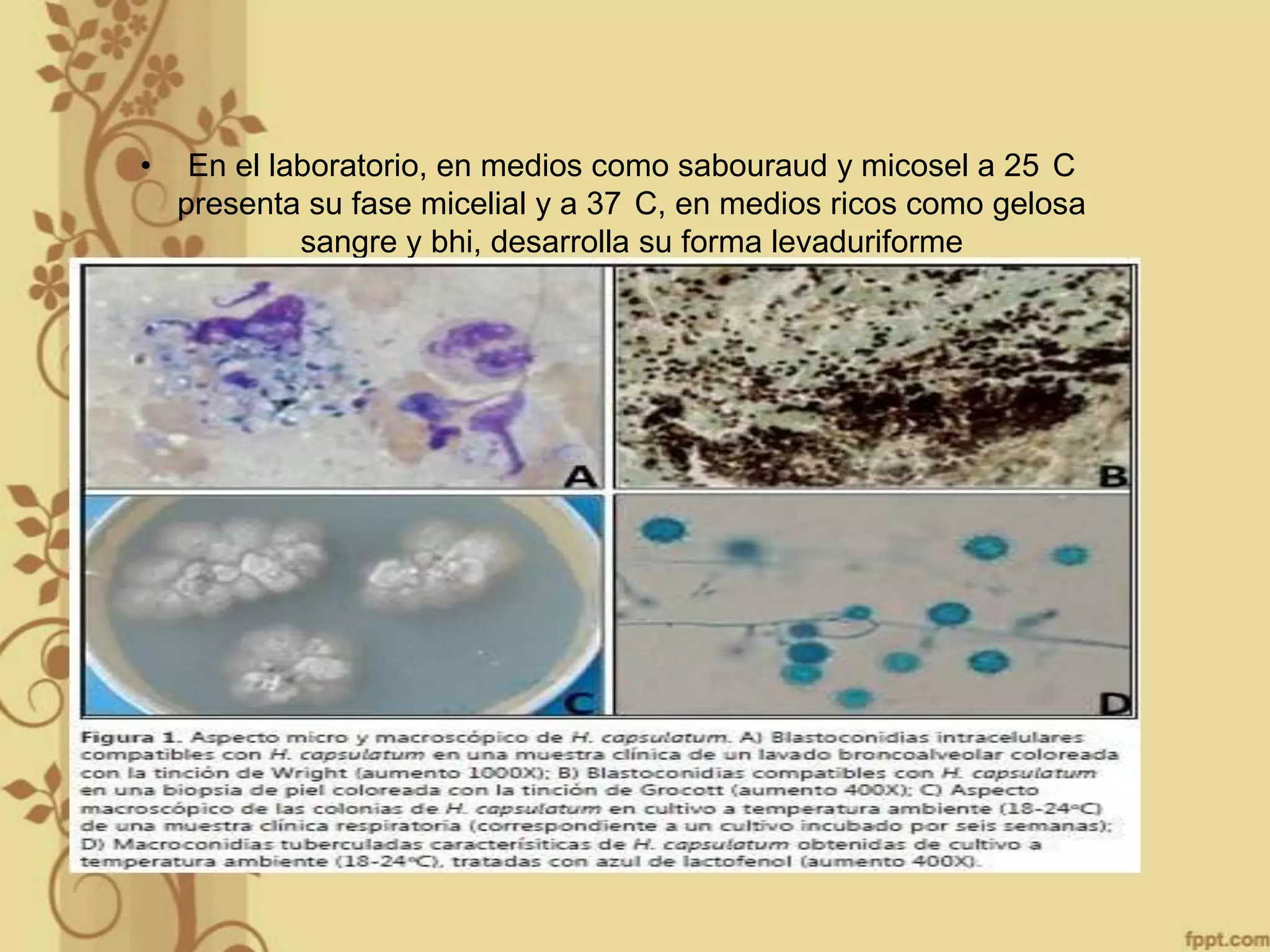 •

En el laboratorio, en medios como sabouraud y micosel a 25 C
presenta su fase micelial y a 37 C, en medios ricos como gelosa
sangre y bhi, desarrolla su forma levaduriforme

 