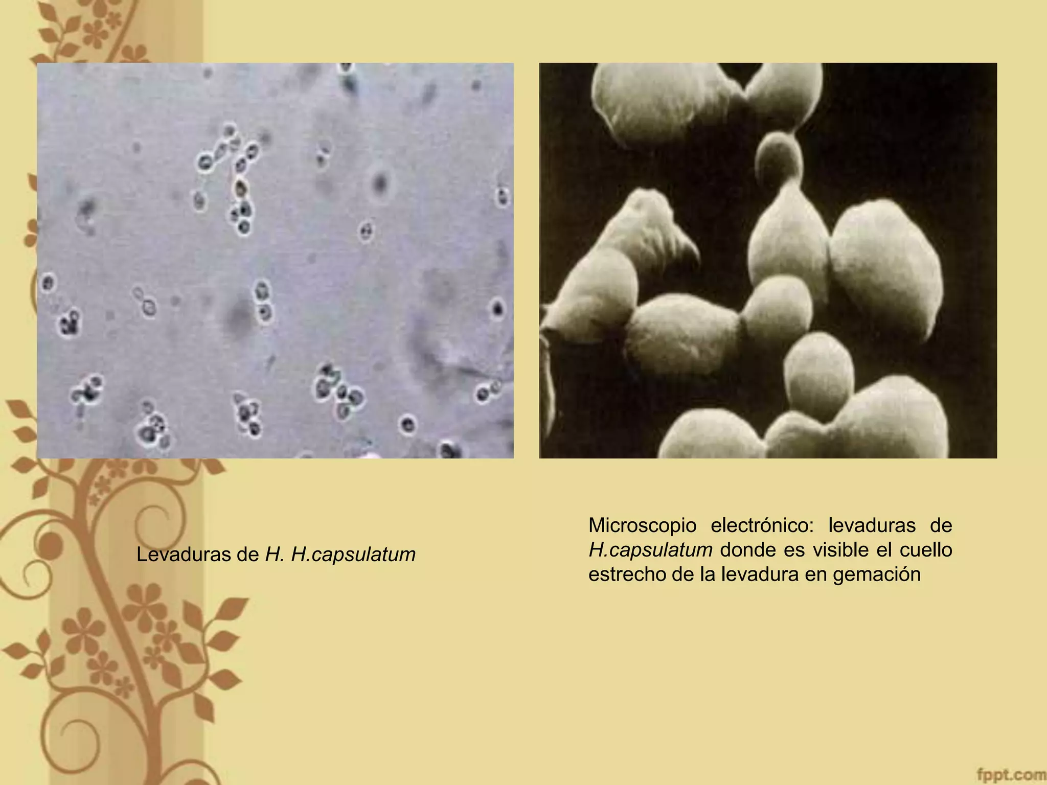 Levaduras de H. H.capsulatum

Microscopio electrónico: levaduras de
H.capsulatum donde es visible el cuello
estrecho de la levadura en gemación

 