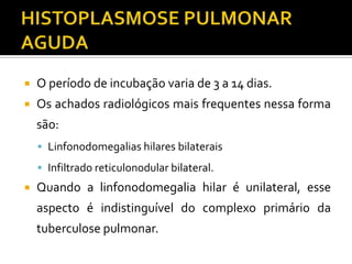    O período de incubação varia de 3 a 14 dias.
   Os achados radiológicos mais frequentes nessa forma
    são:
     Linfonodomegalias hilares bilaterais
     Infiltrado reticulonodular bilateral.
   Quando a linfonodomegalia hilar é unilateral, esse
    aspecto é indistinguível do complexo primário da
    tuberculose pulmonar.
 