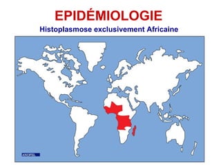 EPIDÉMIOLOGIE
Histoplasmose exclusivement Africaine
 