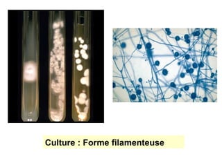 Culture : Forme filamenteuse
 